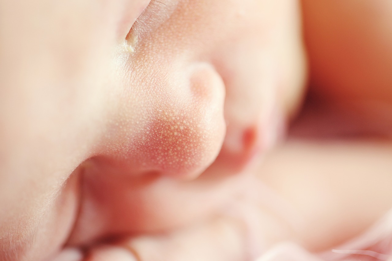 孕妈助孕服务生的婴儿胳膊上有白色斑点（代怀代生套餐生的孩子胳膊上有白色斑点图片）